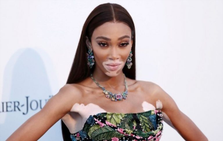 Kyle Kuzma Girlfriend: Winnie Harlow and Other Eccentric Relationships